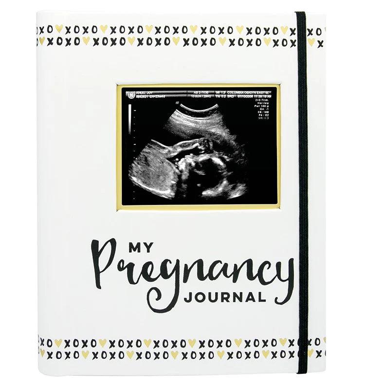 Pearhead Pregnancy Journal - Black, White & Gold - Taylorson