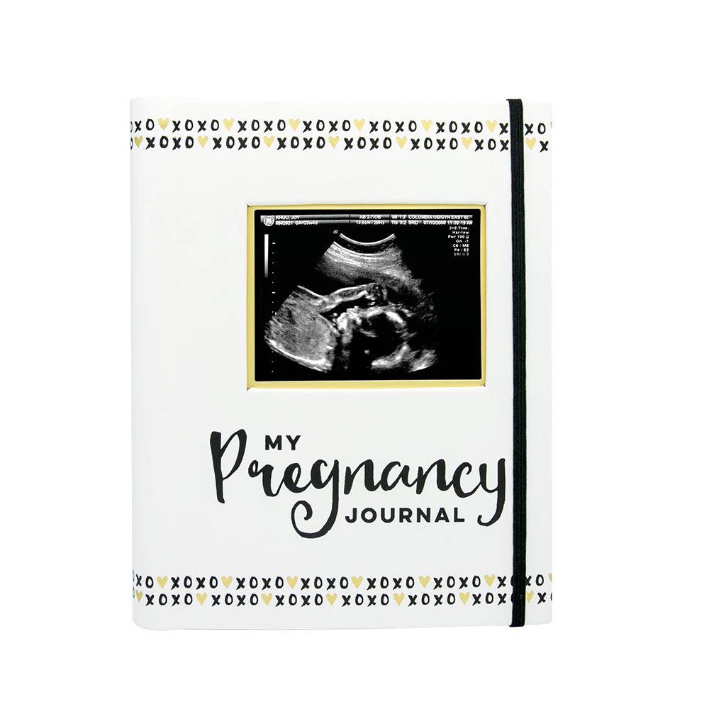 Pearhead Pregnancy Journal - Black, White & Gold - Taylorson